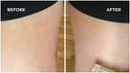Lavender-Scented Oil That Helps Prevent Ingrown Hairs