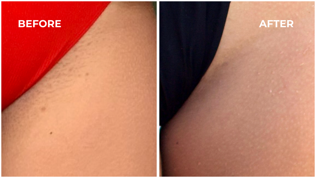 Lavender-Scented Oil That Helps Prevent Ingrown Hairs