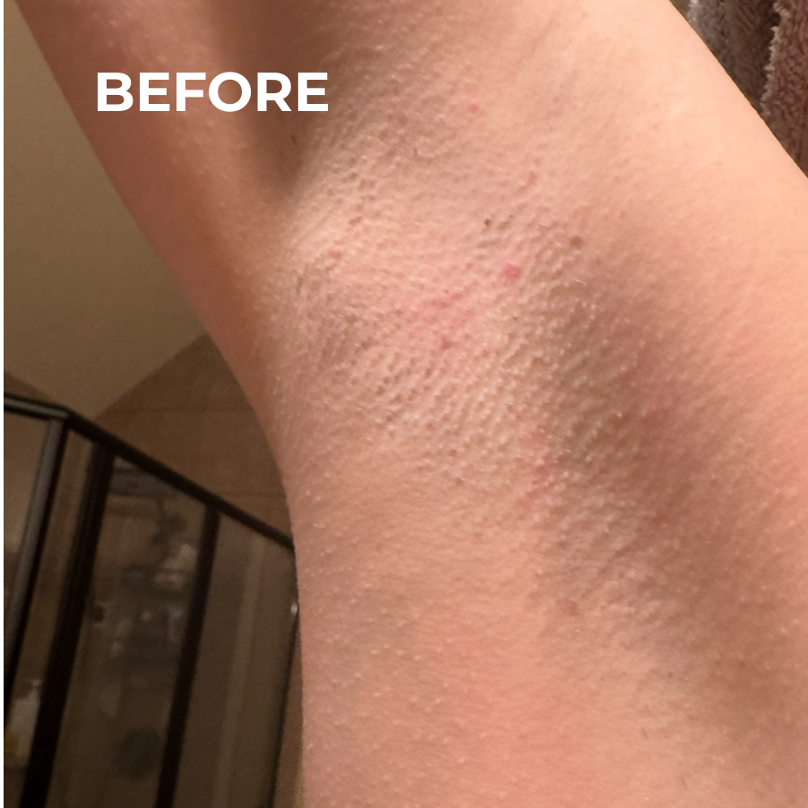 Lavender-Scented Oil That Helps Prevent Ingrown Hairs