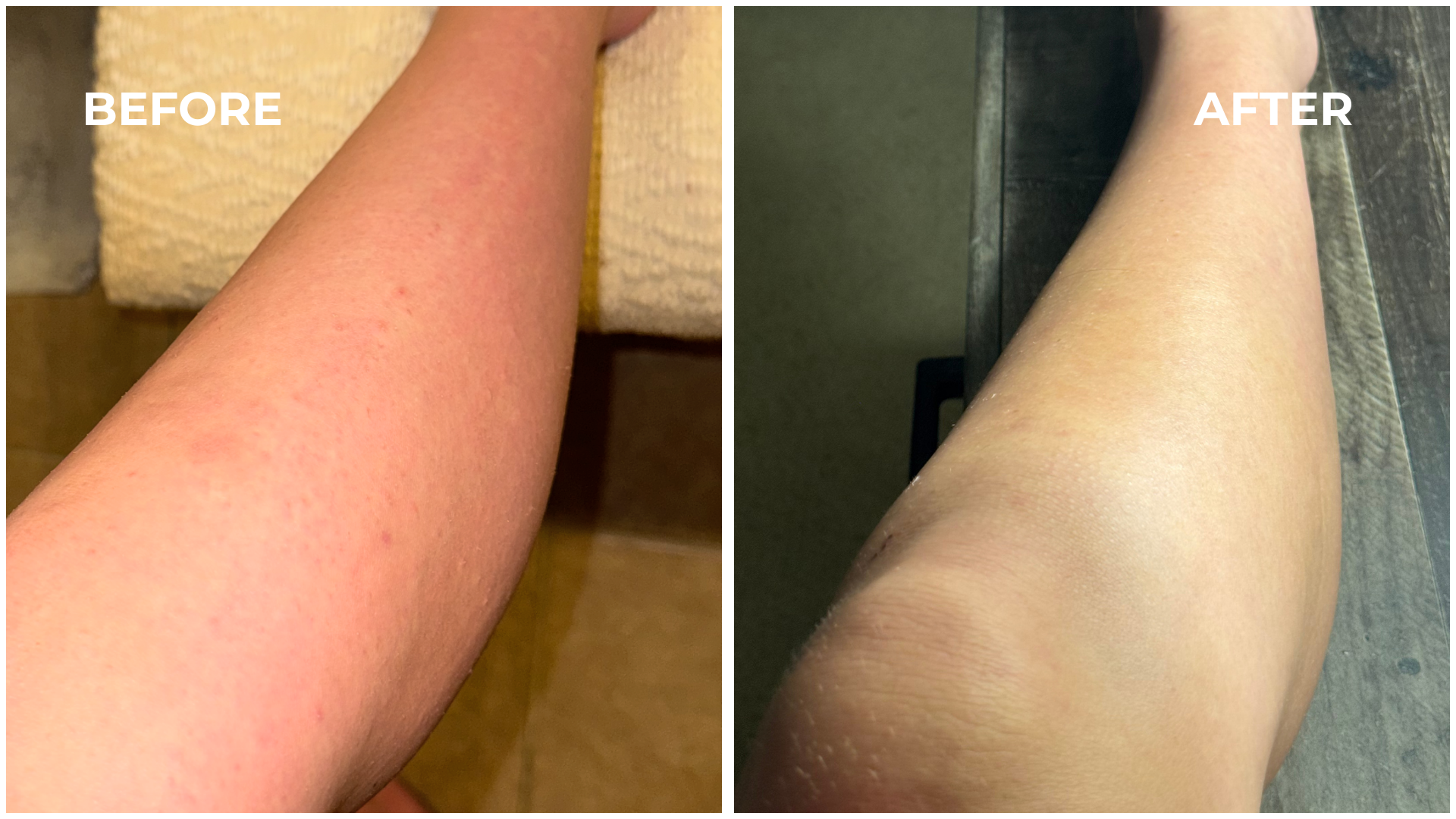 Lavender-Scented Oil That Helps Prevent Ingrown Hairs