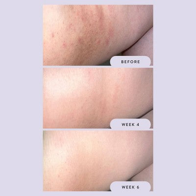 Lavender Overnight Stick for Chafed Thighs