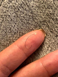 Pointed Tip Tweezers To Extract Ingrowns