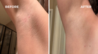Lavender-Scented Oil That Helps Prevent Ingrown Hairs